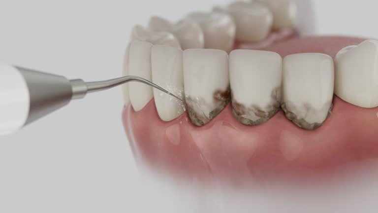 Trusted Teeth Cleaning And Checkup service in Hawthorne, FL - Dentist Open Now
